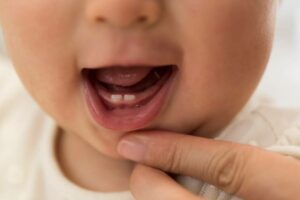 Denti da latte, ecco perché spuntano precocemente: c'entra la mamma